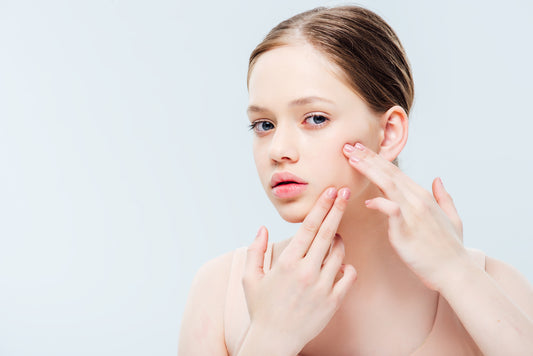 Why are teens more prone to acne?