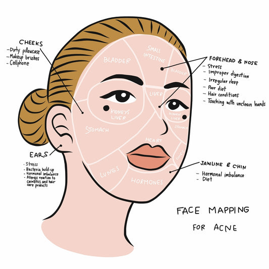 Acne face map: Science or myth?